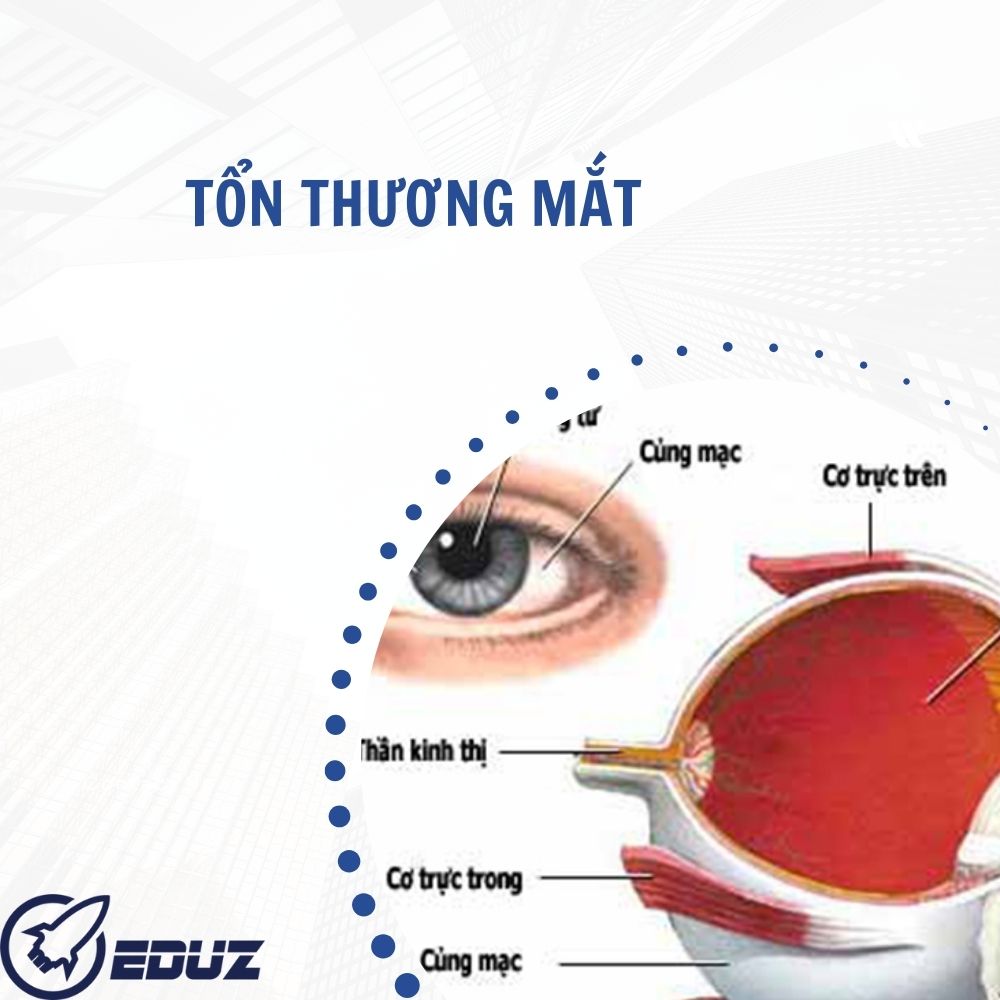 Ba phút sơ cứu - Tổn Thương Mắt